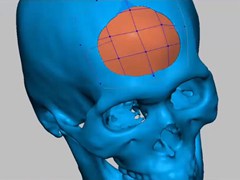 ���ʹ��Geomagic������­ֲ�����